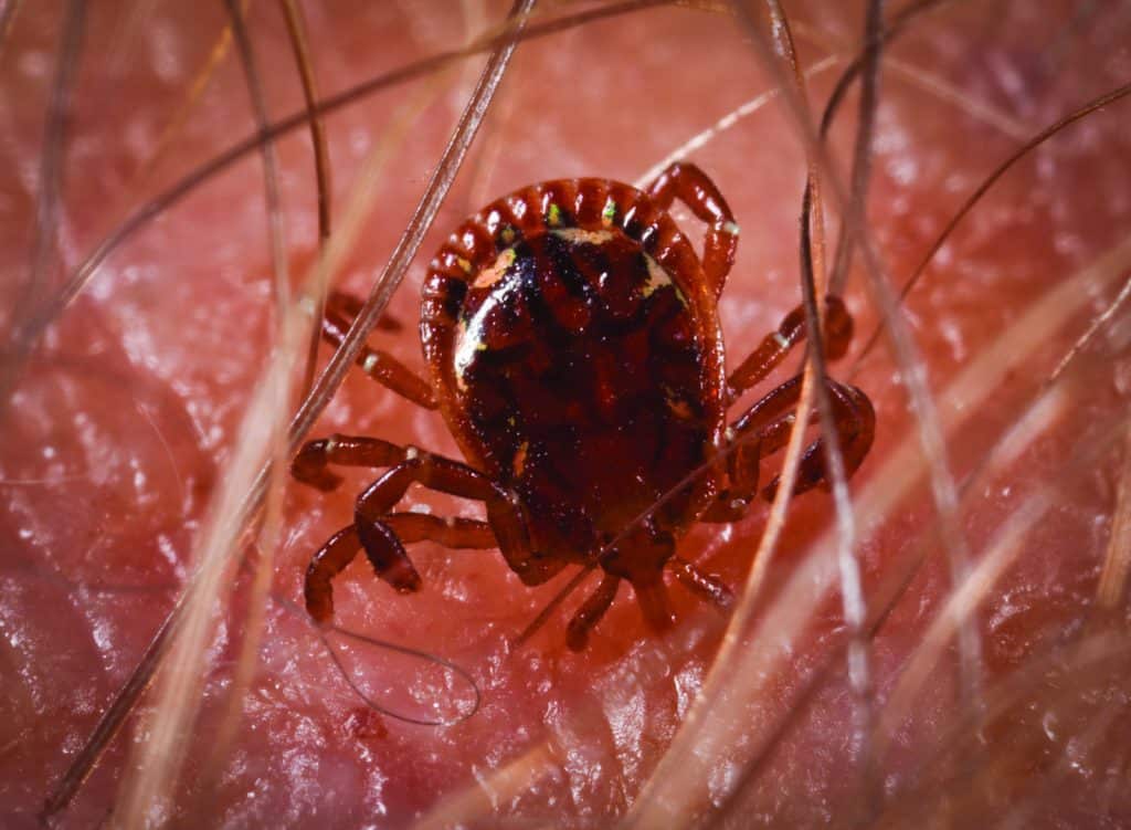 How to Get Rid of Ticks How to Get Rid of Ticks
