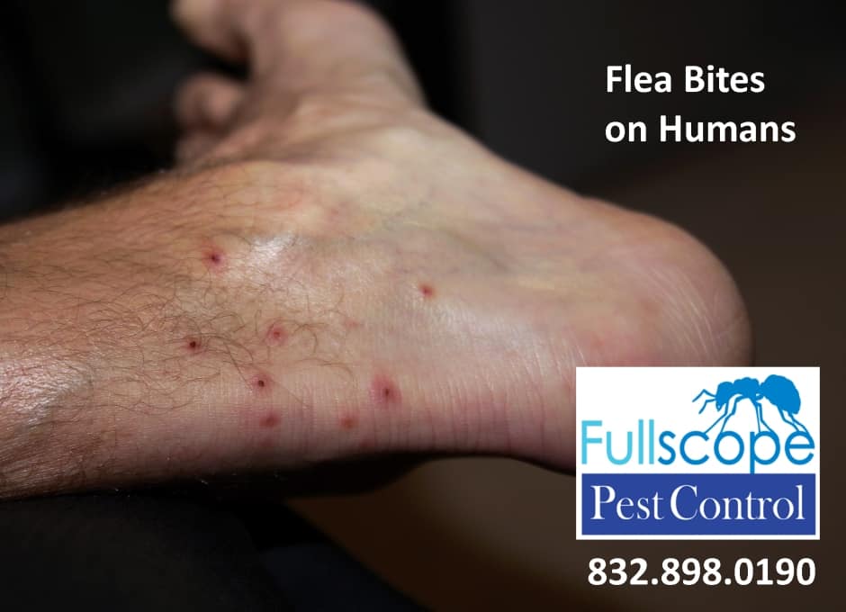 Fleas bites on humans